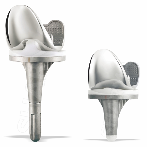 ENTICE Total Knee Replacement